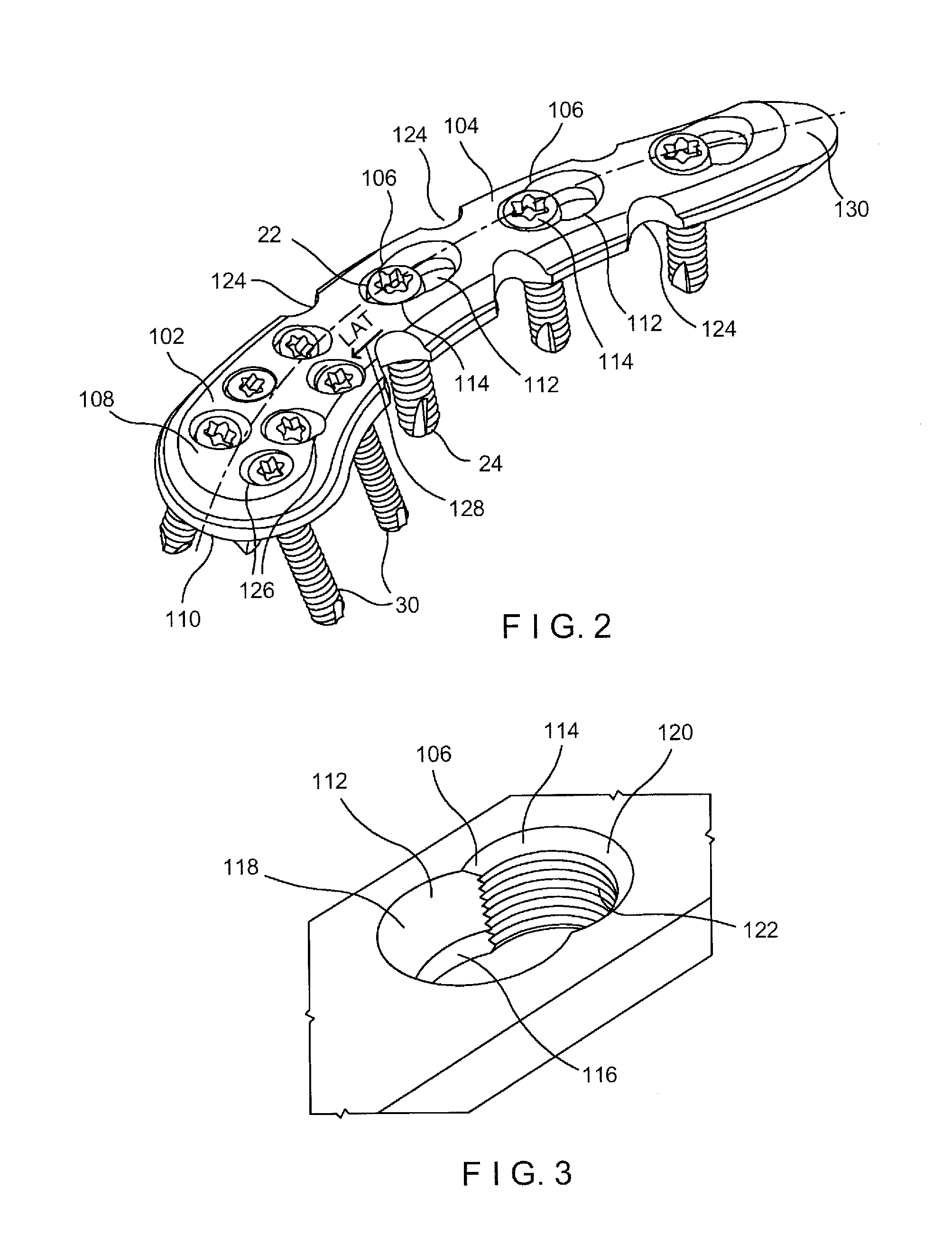 System and method for minimally invasive clavicle plate application