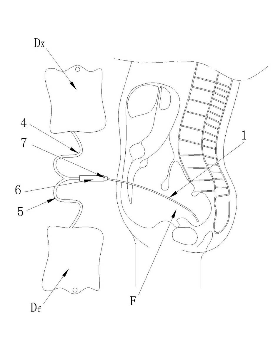 Peritoneal dialysis catheter positioning and adjusting device