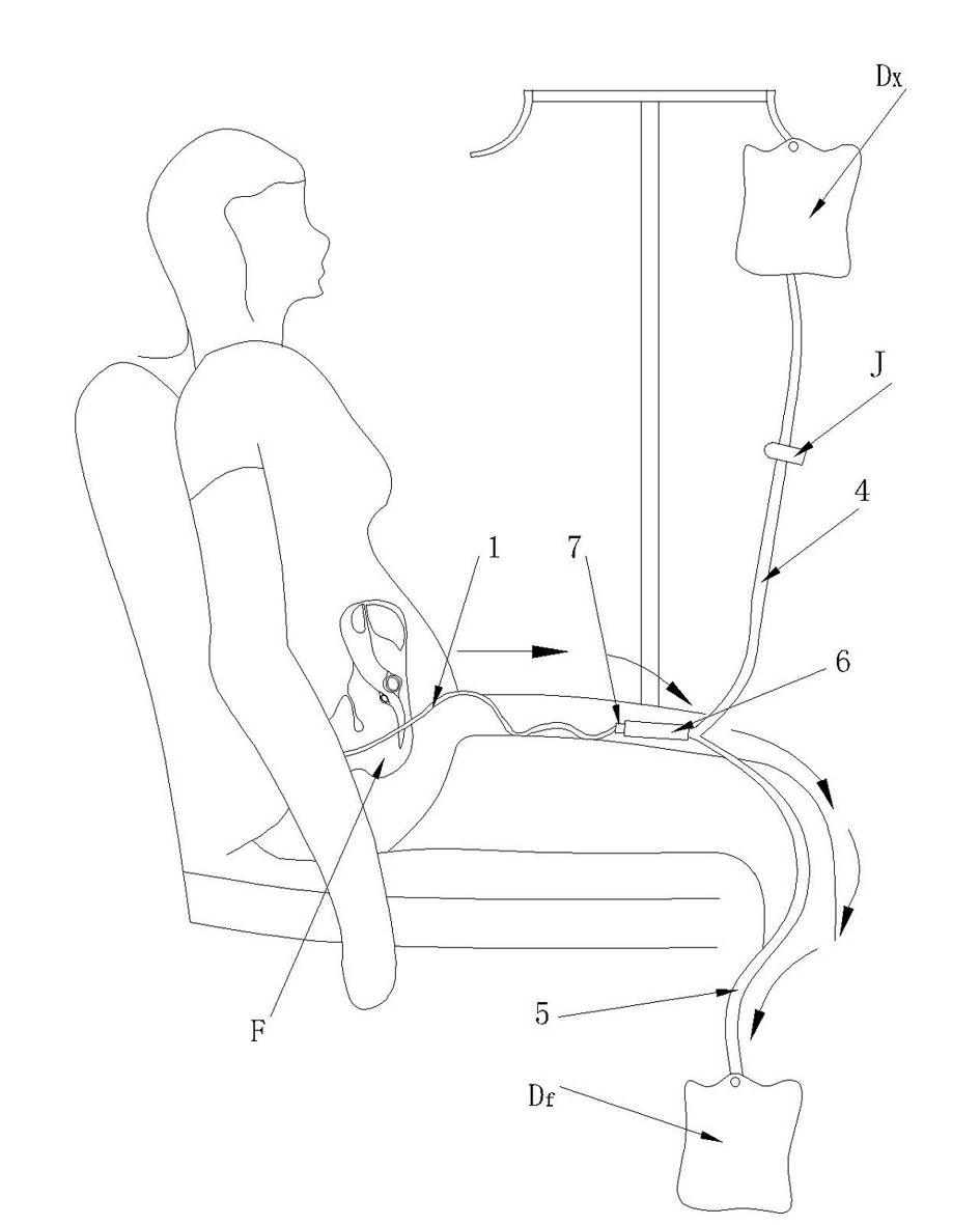 Peritoneal dialysis catheter positioning and adjusting device