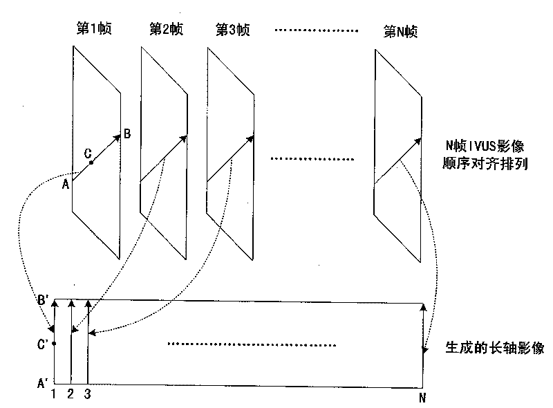 Method for structuring ultrasound long axis image quickly with high fidelity