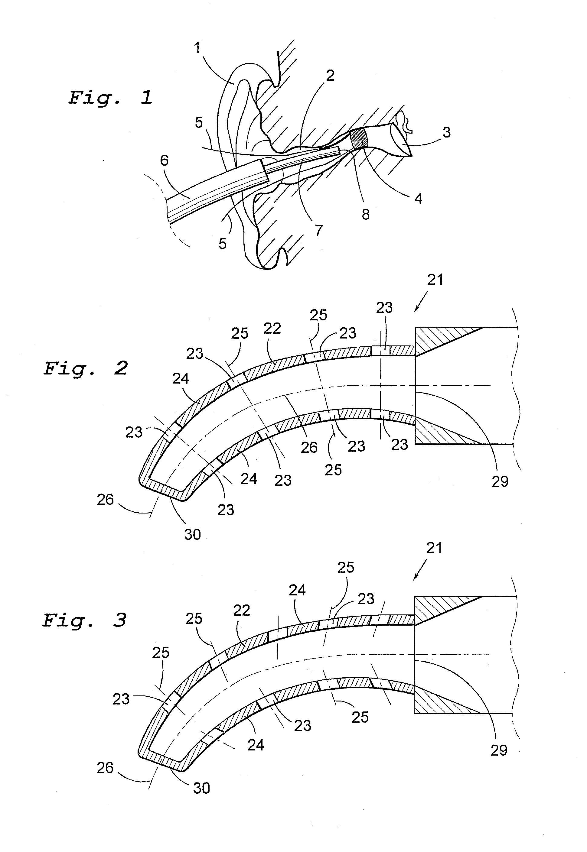 Device for taking impression of an ear