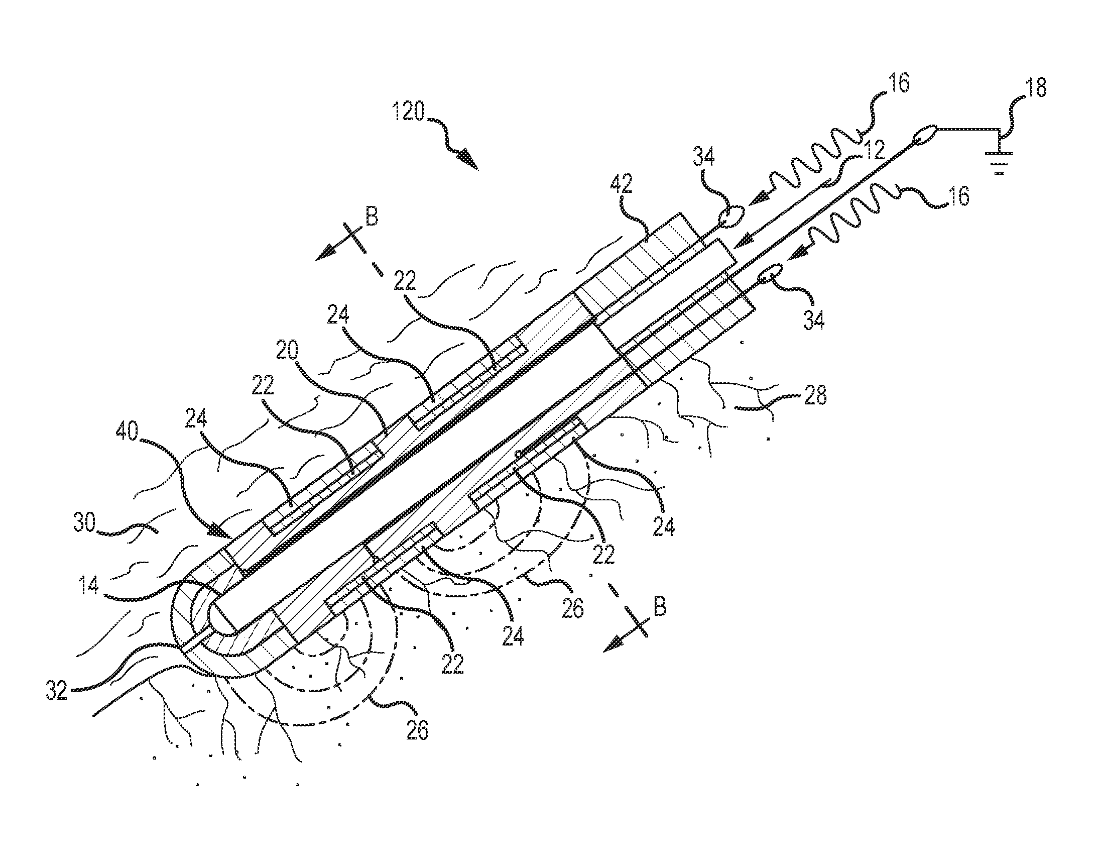 Pressure-sensitive flexible polymer bipolar electrode