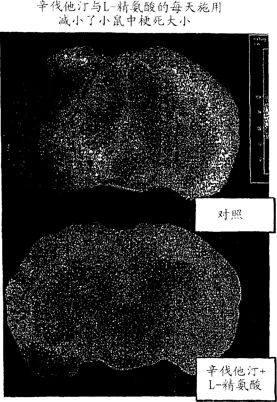 Sustained release l-arginine formulations and methods of manufacture and use