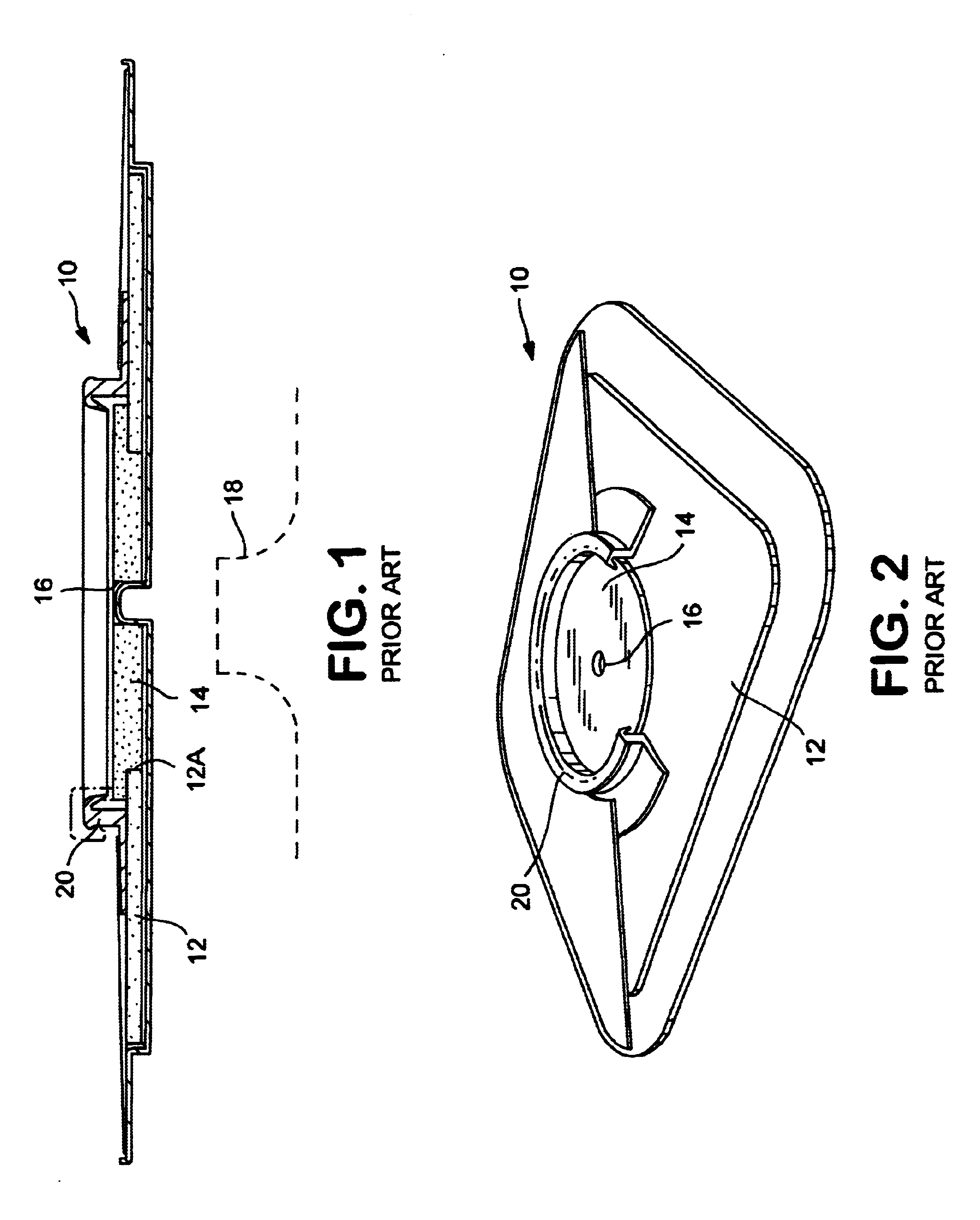 Ostomy appliance