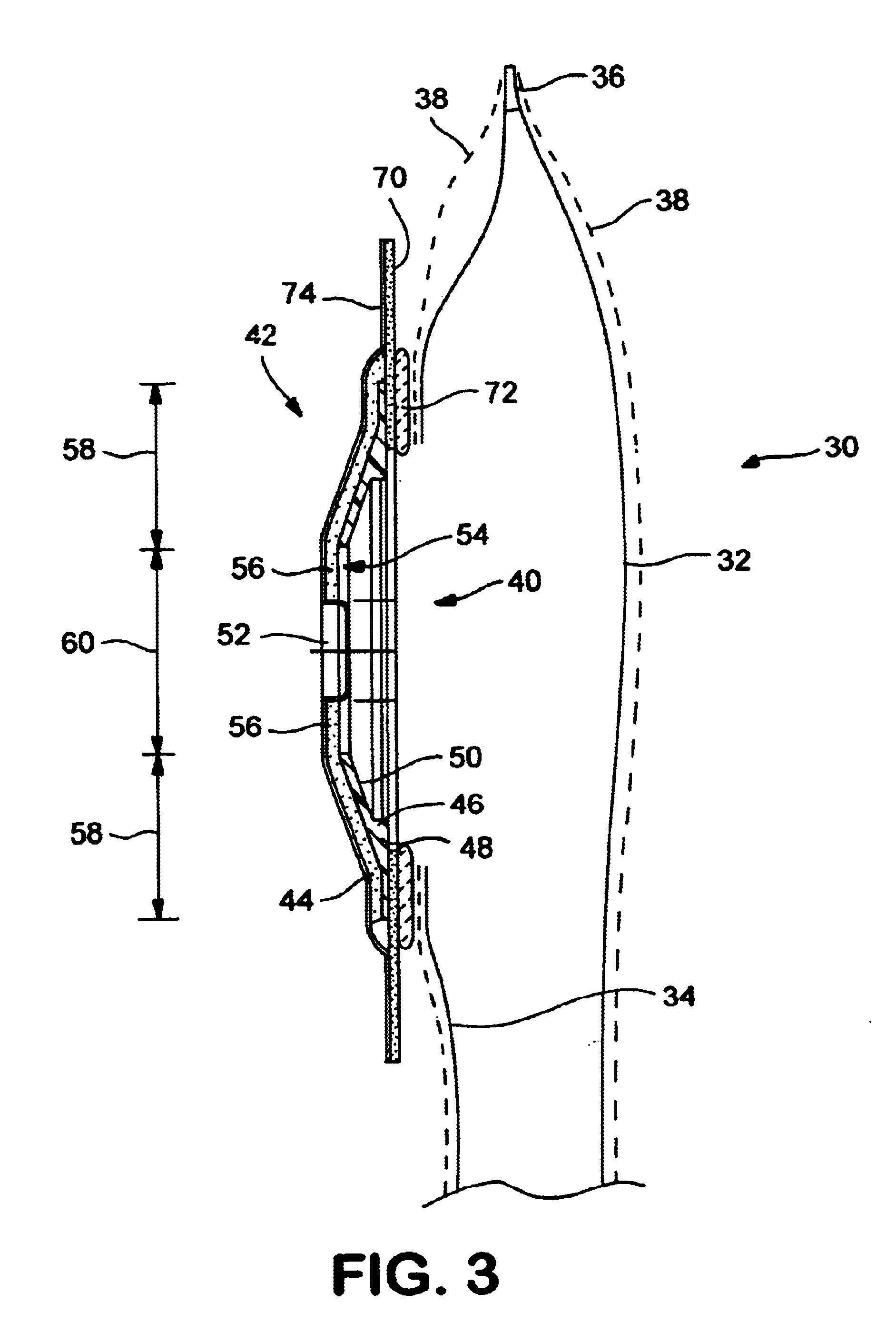 Ostomy appliance