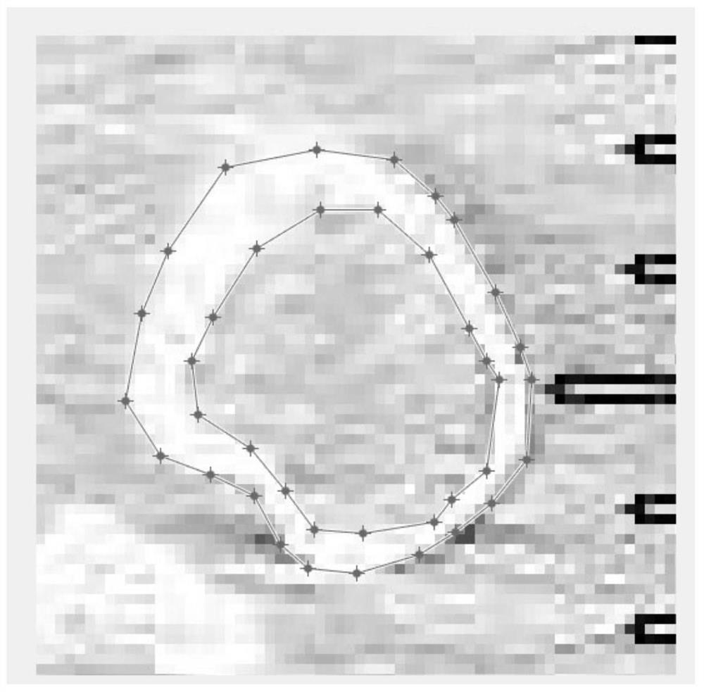 High-precision semi-automatic blood vessel 3D reconstruction algorithm based on CT image