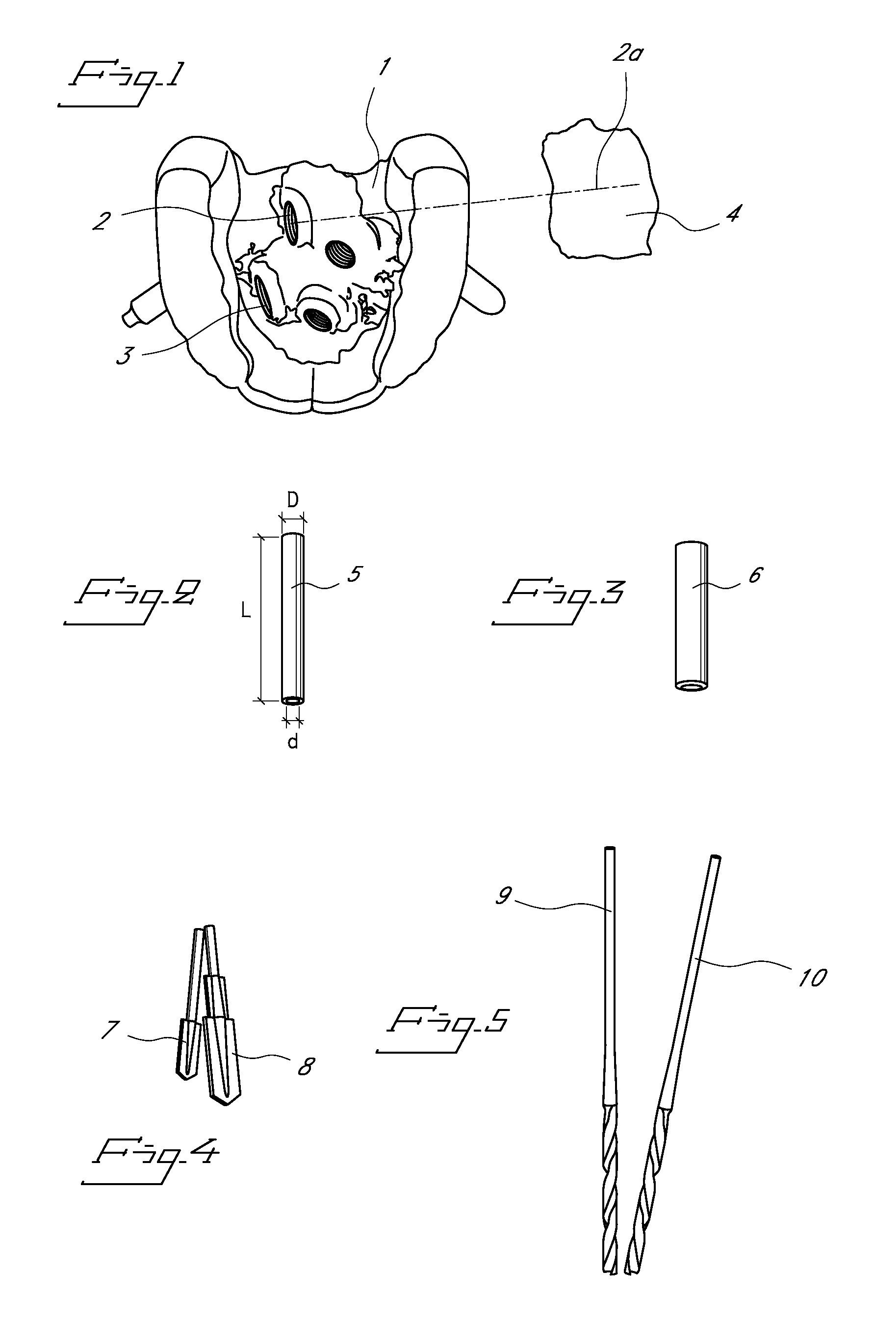 Drill template arrangement