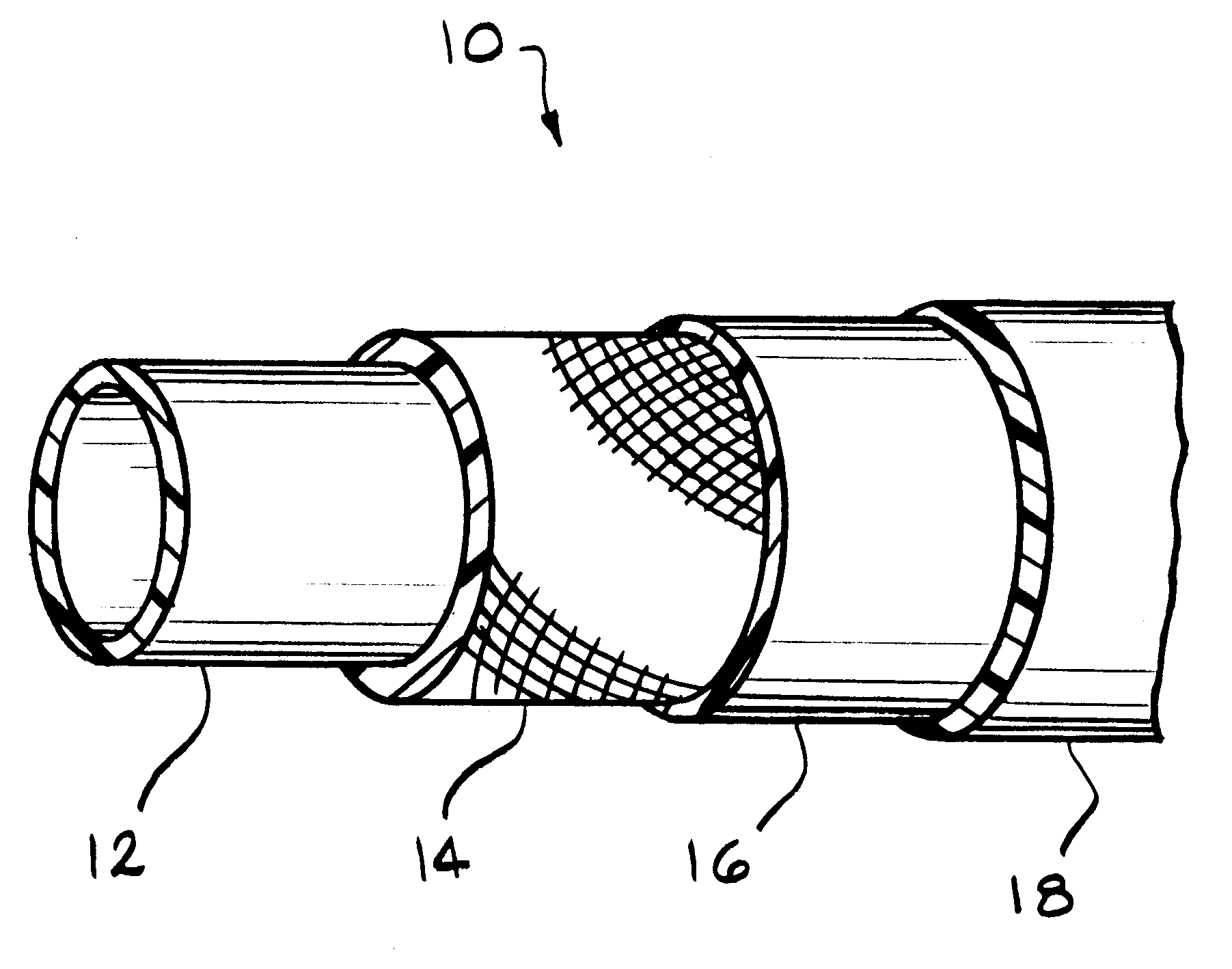 Flexible hose