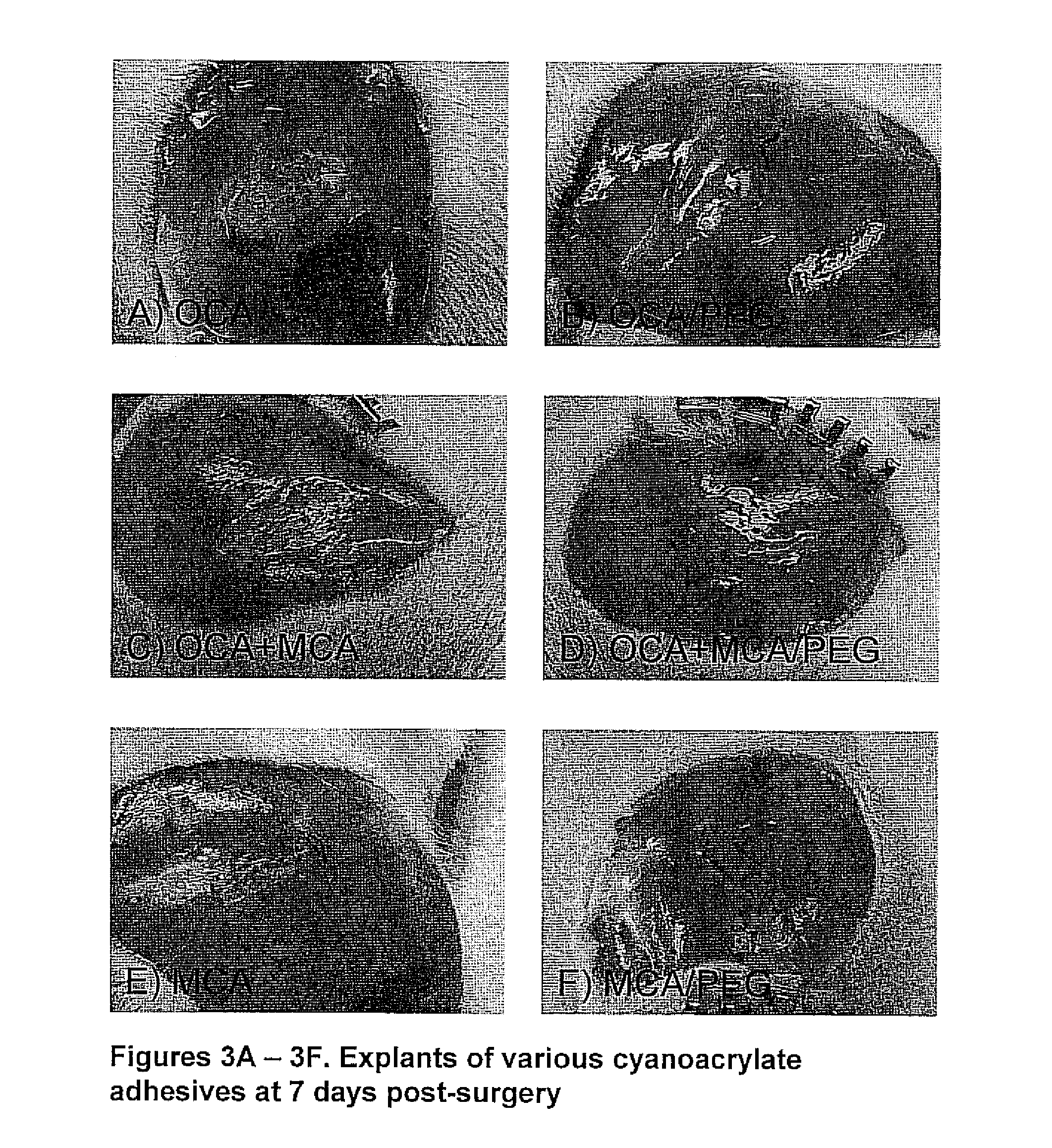 Cyanoacrylate tissue adhesives