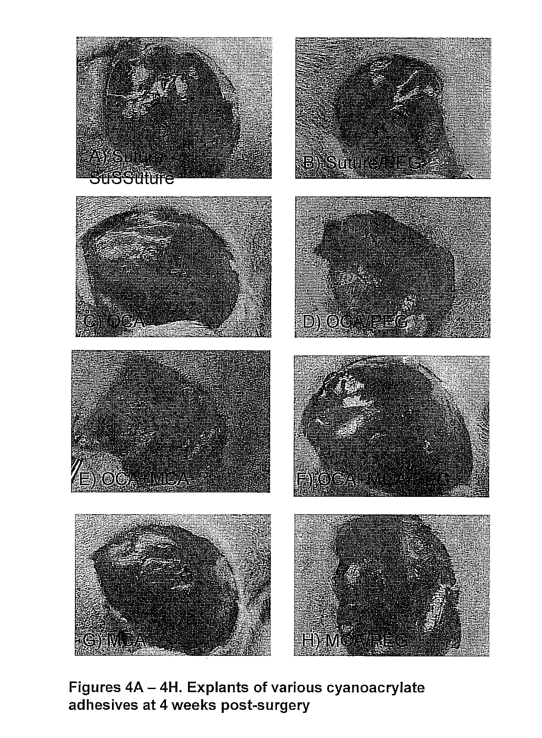 Cyanoacrylate tissue adhesives