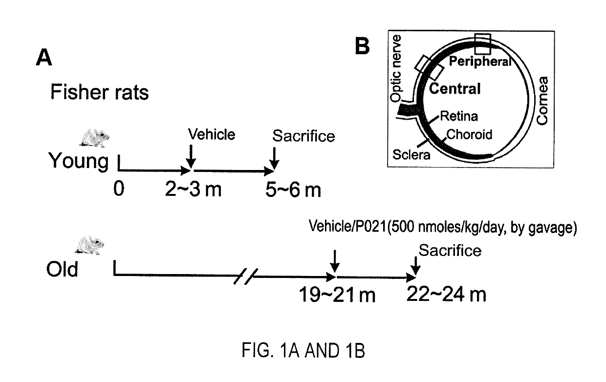 Treatment of age-related macular degeneration with neurotrophic peptidergic compound