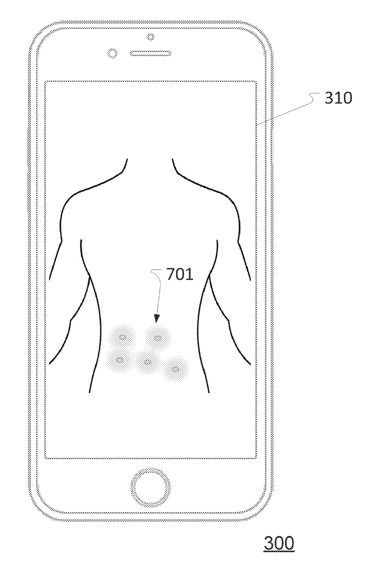 Position determination device and system for determining and registering an injection location