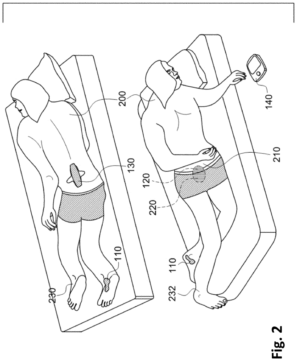 Nocturia reduction system