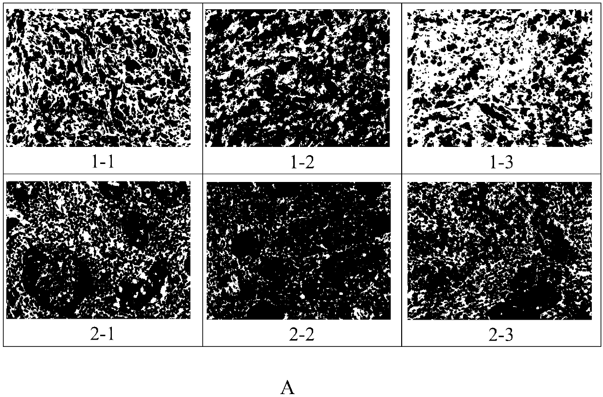 Mesothelin immunohistochemical detection kit