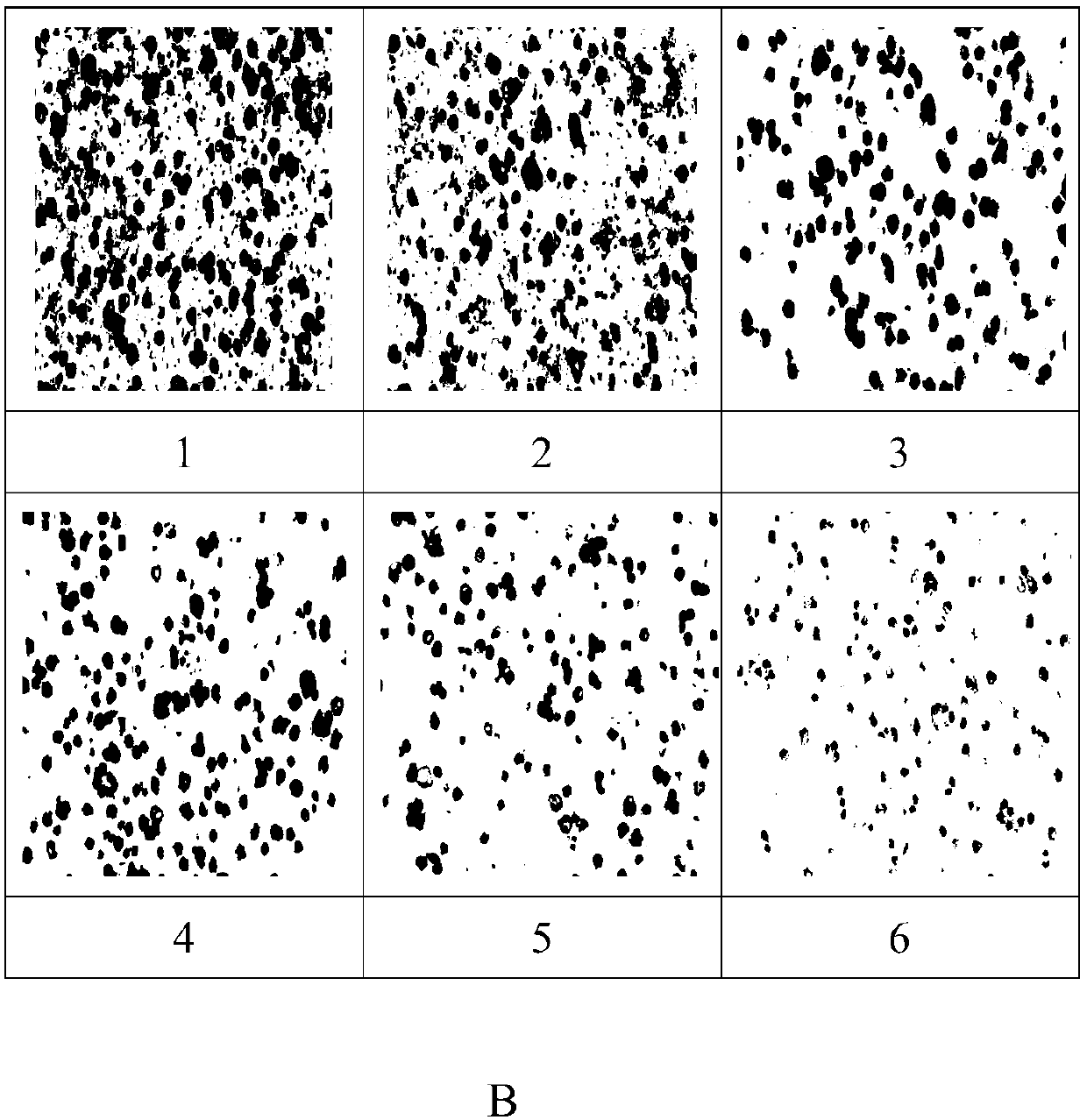 Mesothelin immunohistochemical detection kit