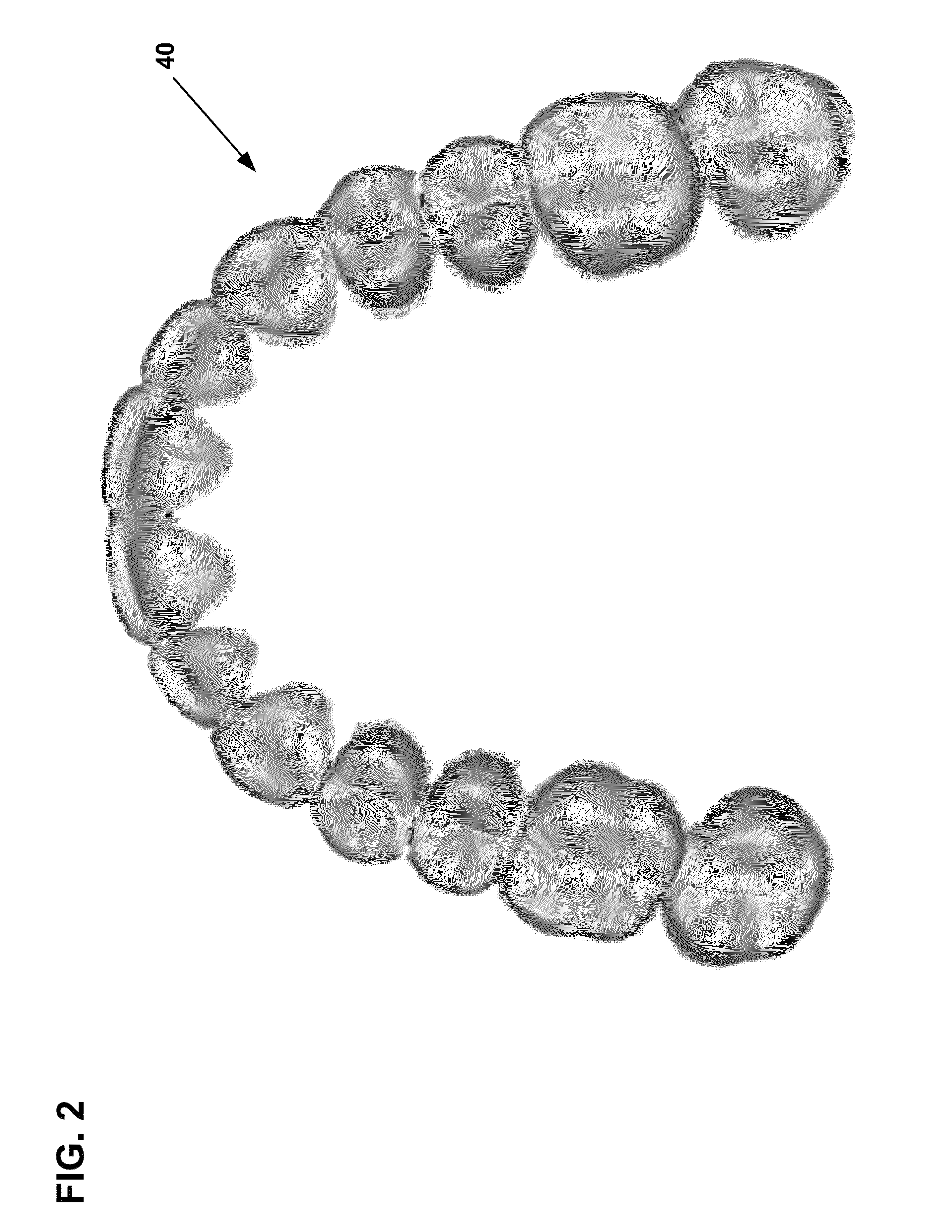 System and method for evaluating orthodontic treatment