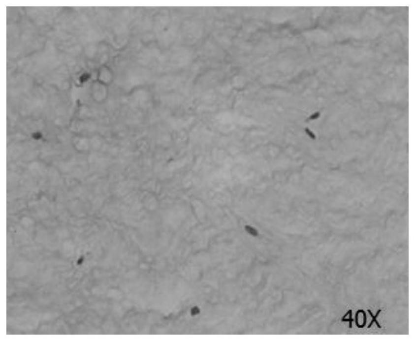 Preparation and cryopreservation method and application of human placental amniotic membrane and decidua tissue