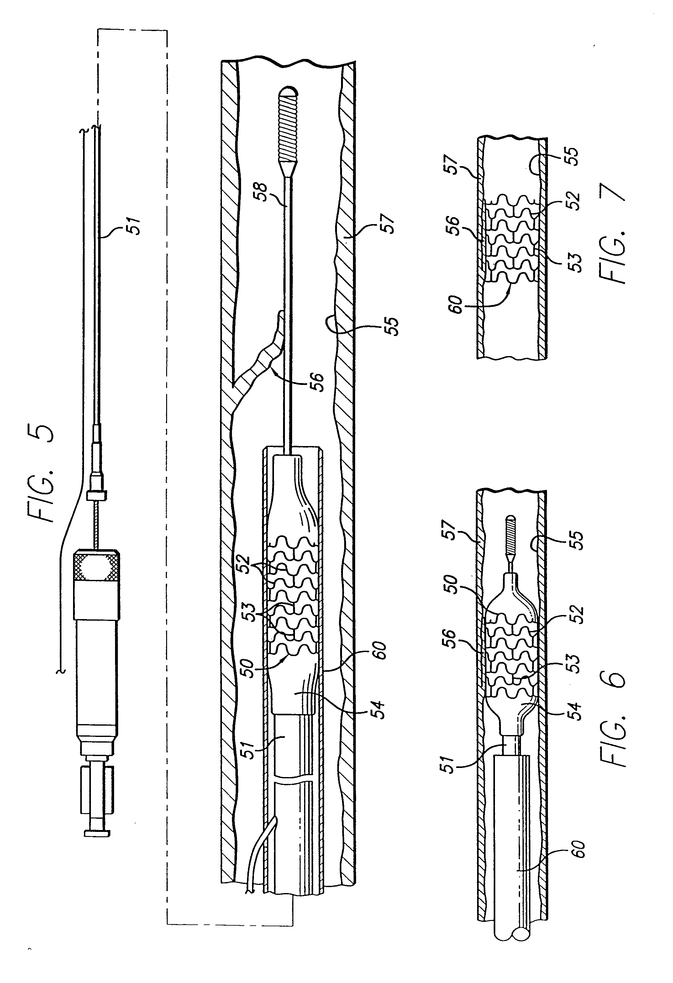 High strength member for intracorporeal use