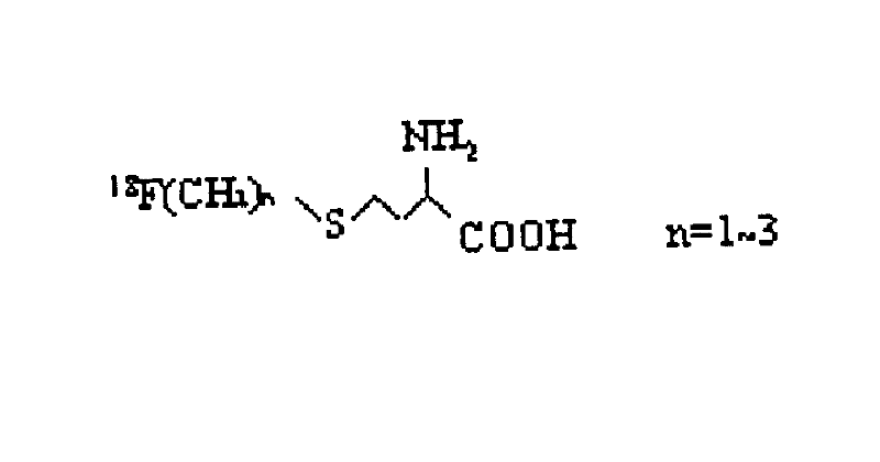 Tumour positive electron developer S-(18 fluro-n-alkyl)-L-methionine and its preparation method