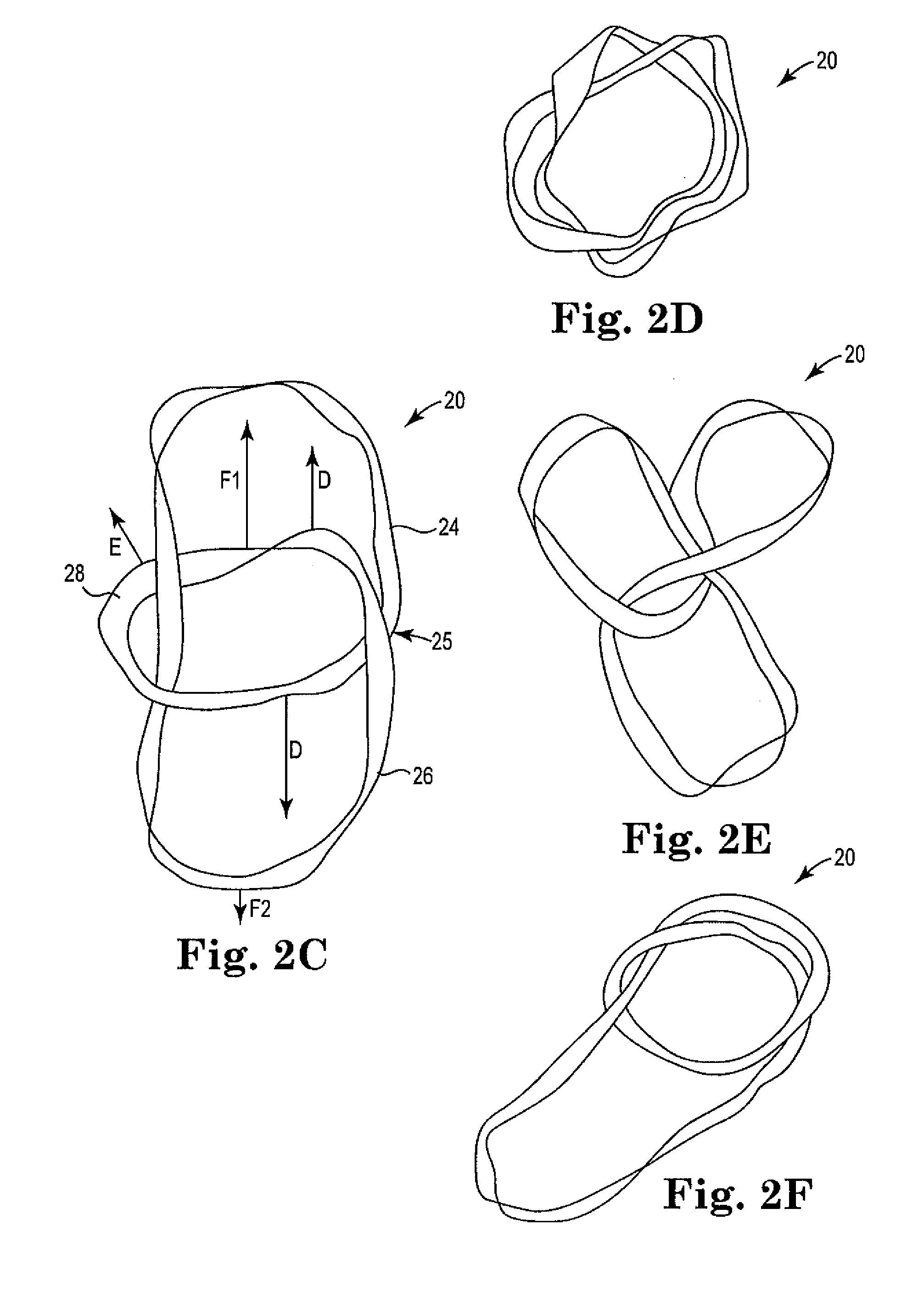 Closed loop device incorporating one or more indecomposable knots and methods of using