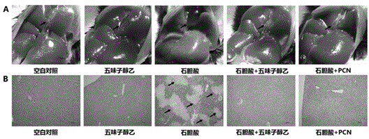 Application of schisandrol B in preparation of medicine for preventing and treating cholestatic liver disease