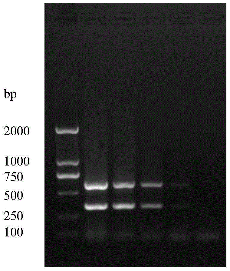 Primers and detection kits for differential diagnosis of strong and weak strains of porcine epidemic diarrhea virus