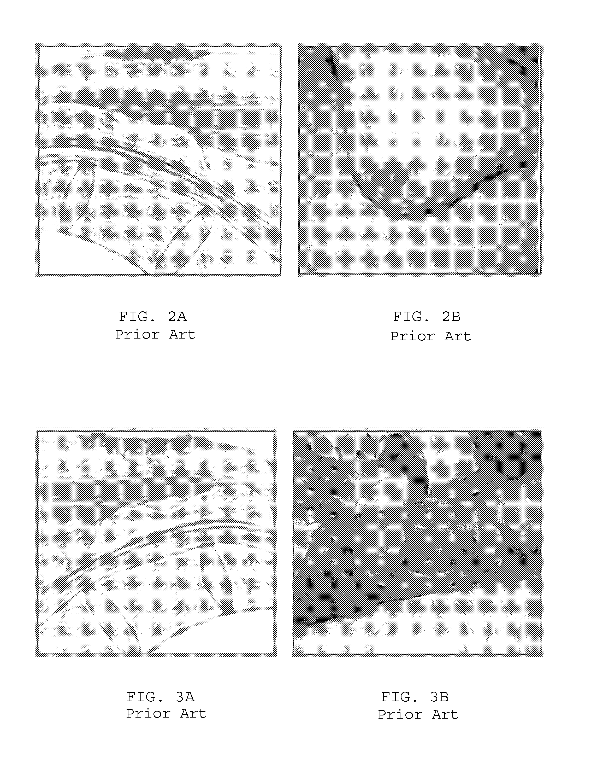 Systems for relieving pressure sores and methods therefor