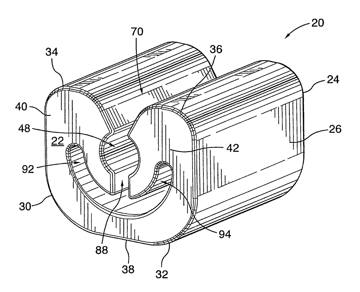 Orthodontic gripping device