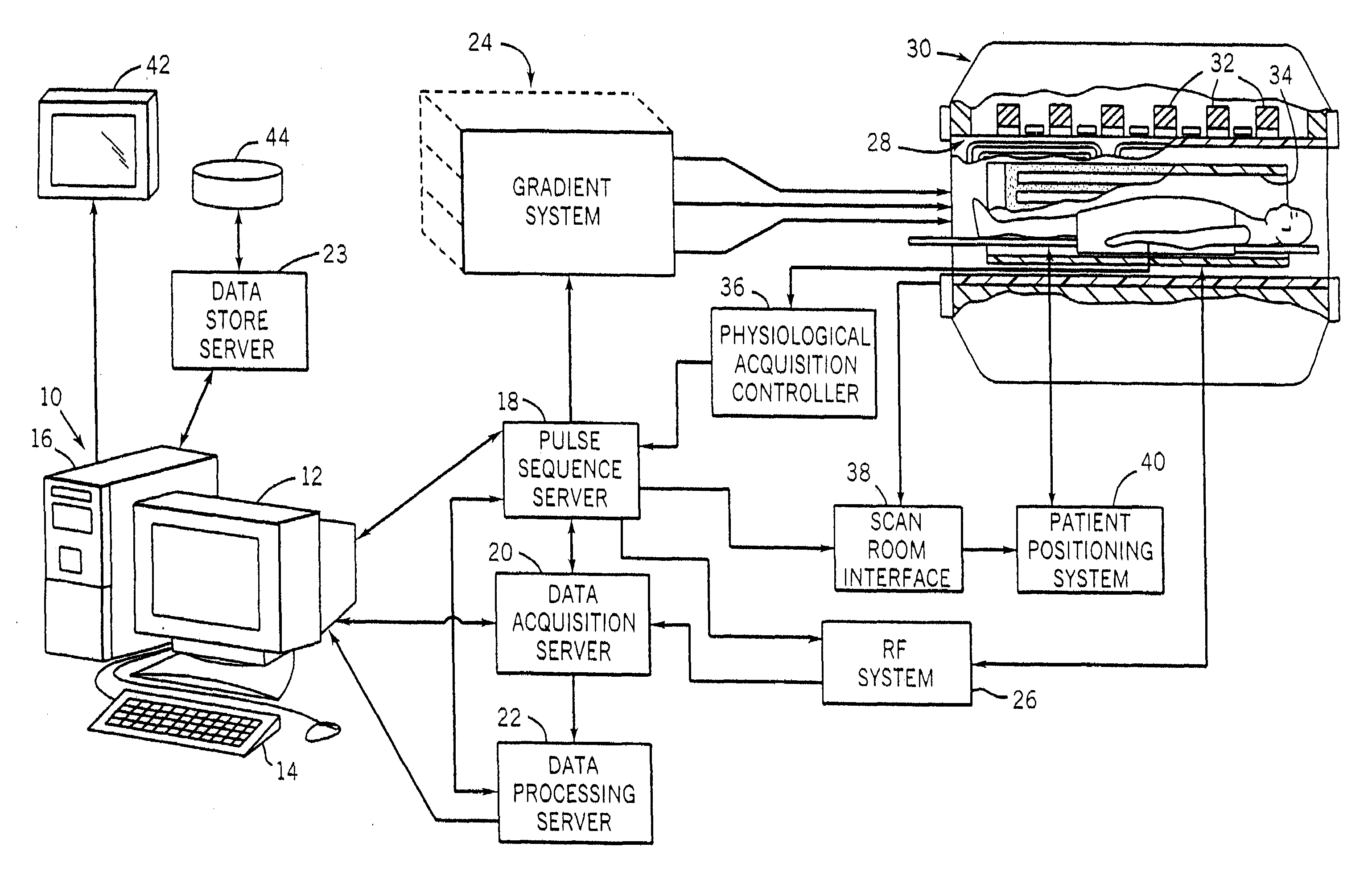 Accelerated Shells Trajectory MRI Acquisition