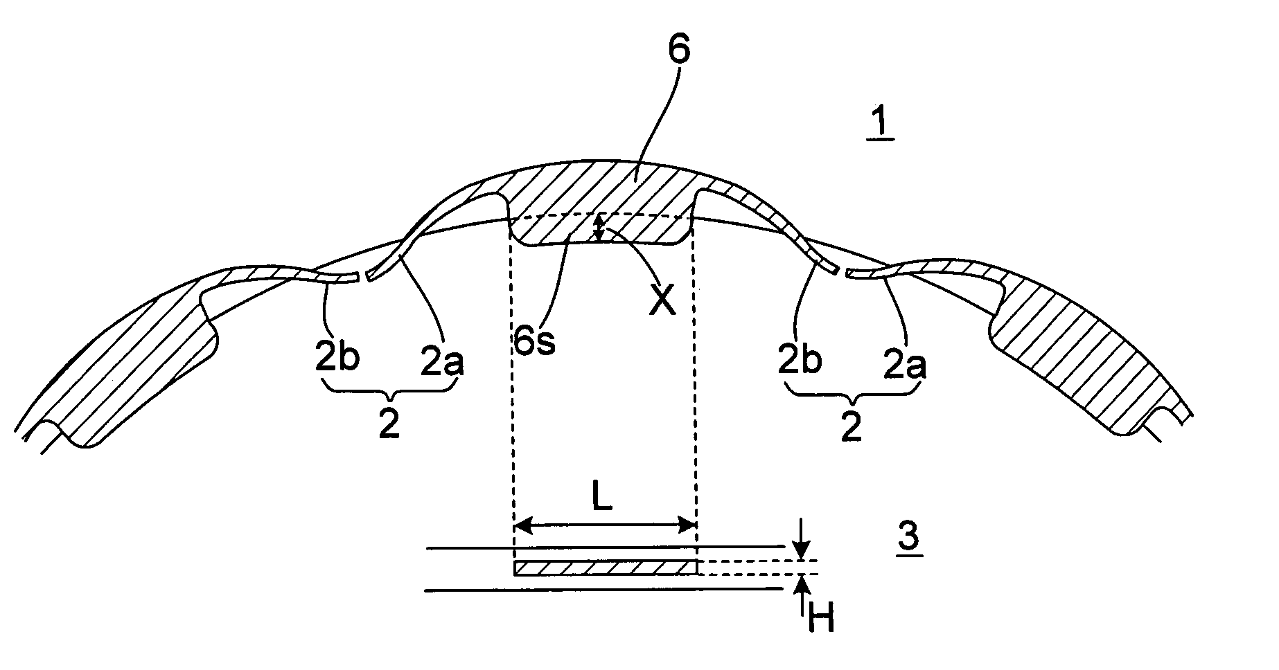 Multipoint ignition device