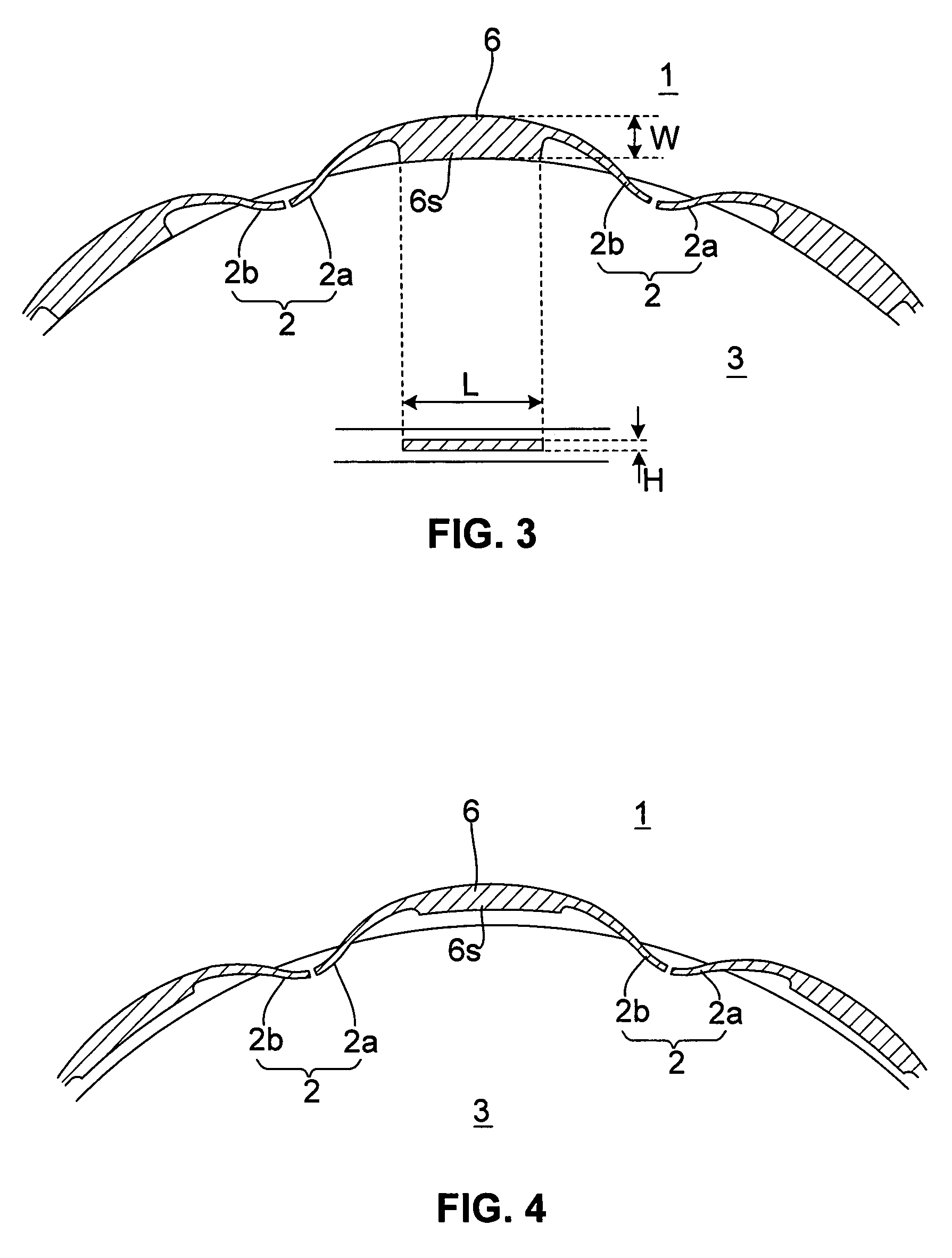 Multipoint ignition device