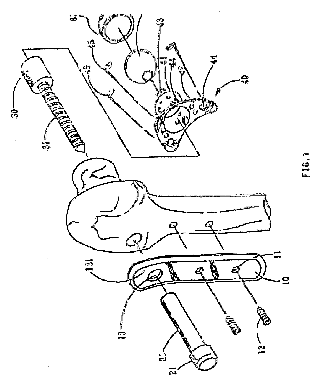 Artificial hip joint without a shaft