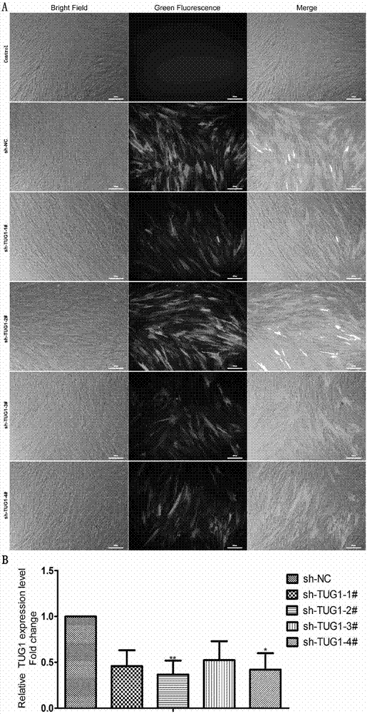 Application of LncRNA-TUG1 in preparation of drug for regulating and controlling dryness maintenance capacity of periodontal ligament stem cells