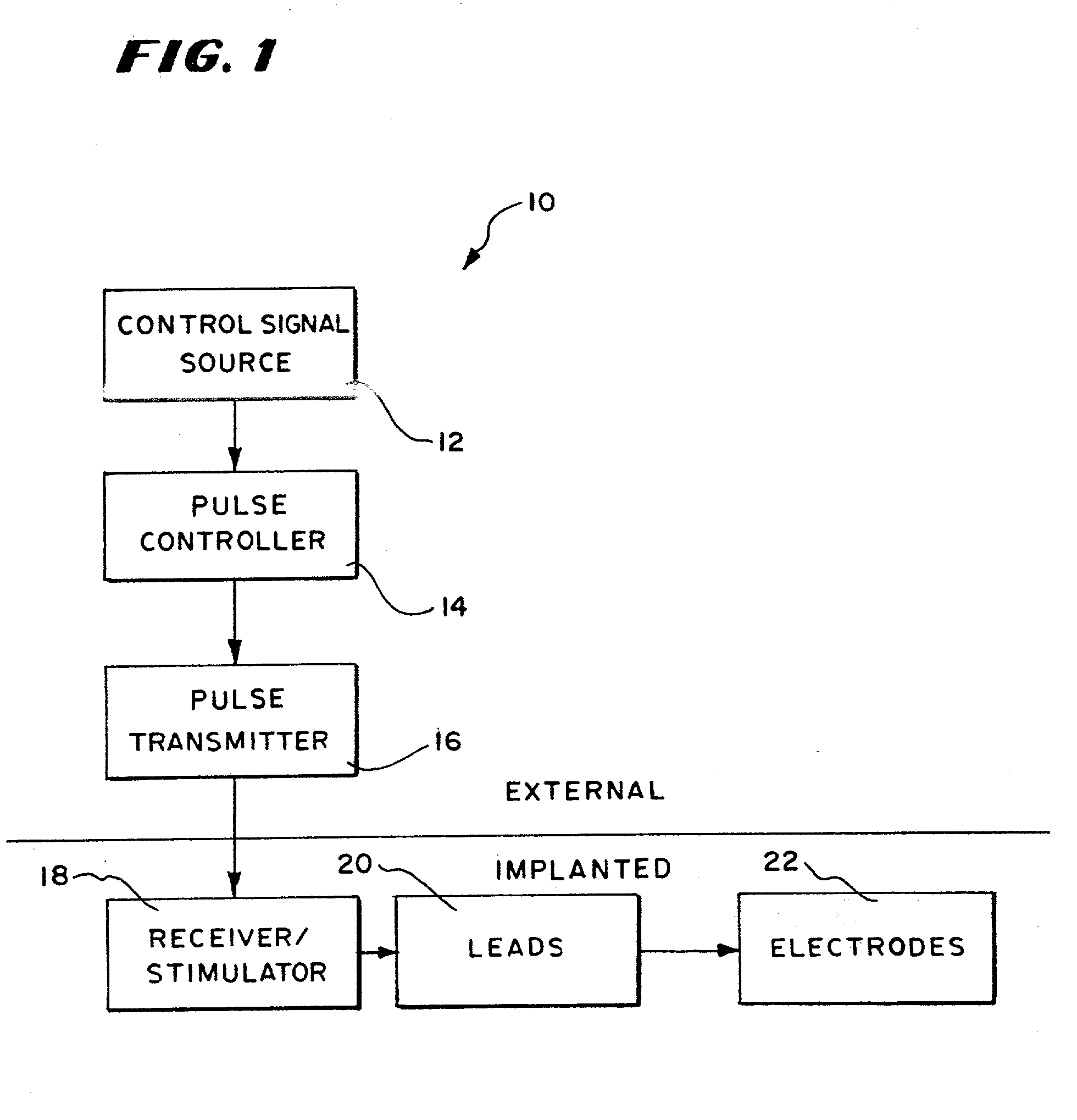 Systems and methods for performing prosthetic or therapeutic neuromuscular stimulation using a universal external controller accommodating different control inputs and/or different control outputs