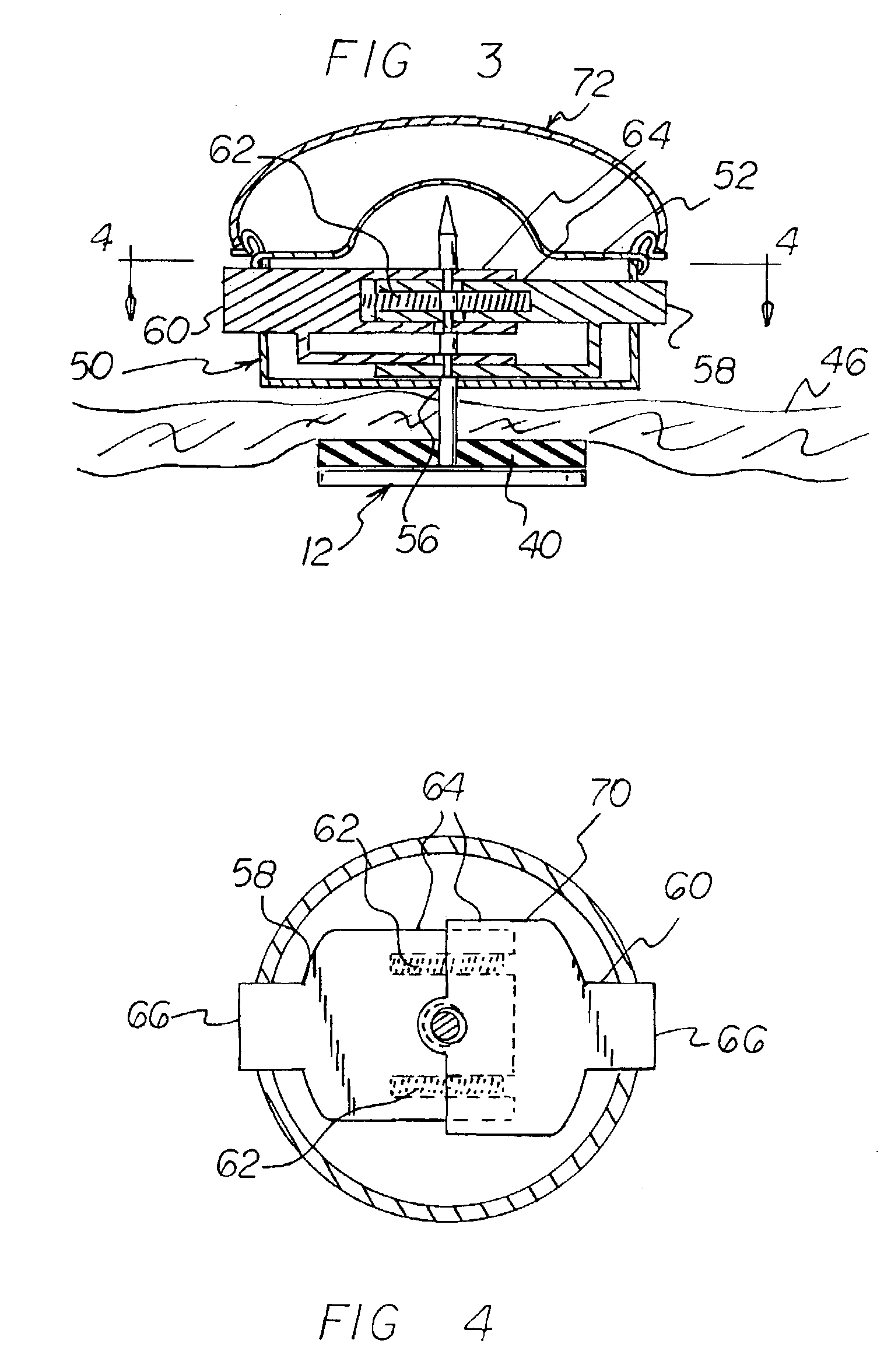 Interlocking pin system