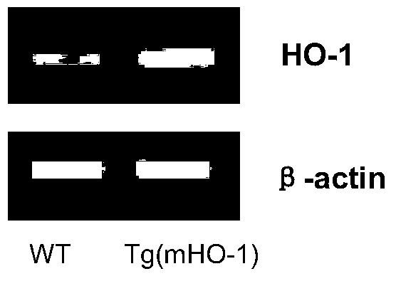 A method for generating a ho-1/app/psen1 triple transgenic mouse model of Alzheimer's disease