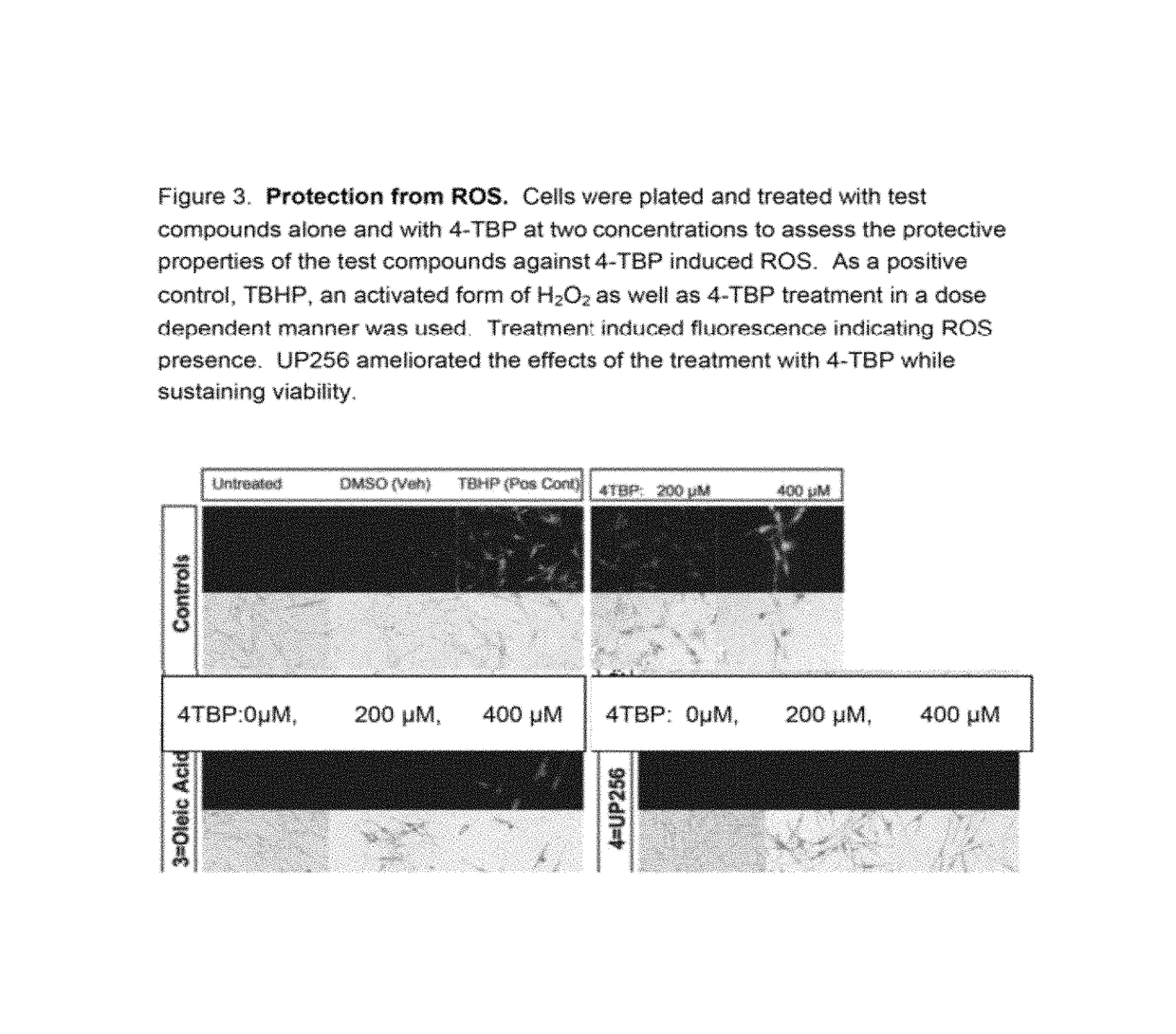 Bakuchiol compositions for treatment of post inflammatory hyperpigmentation