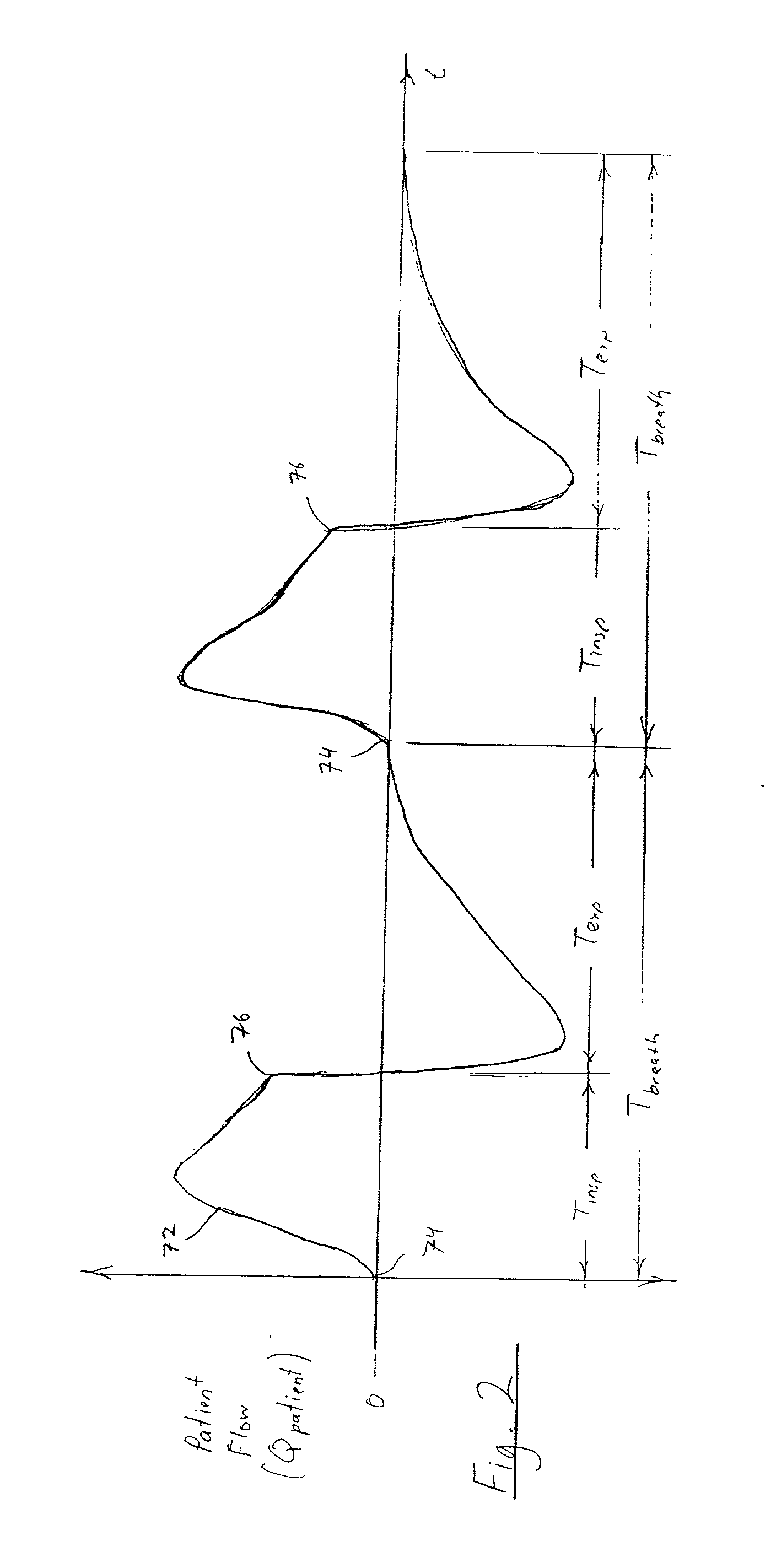 Medical ventilator triggering and cycling method and mechanism