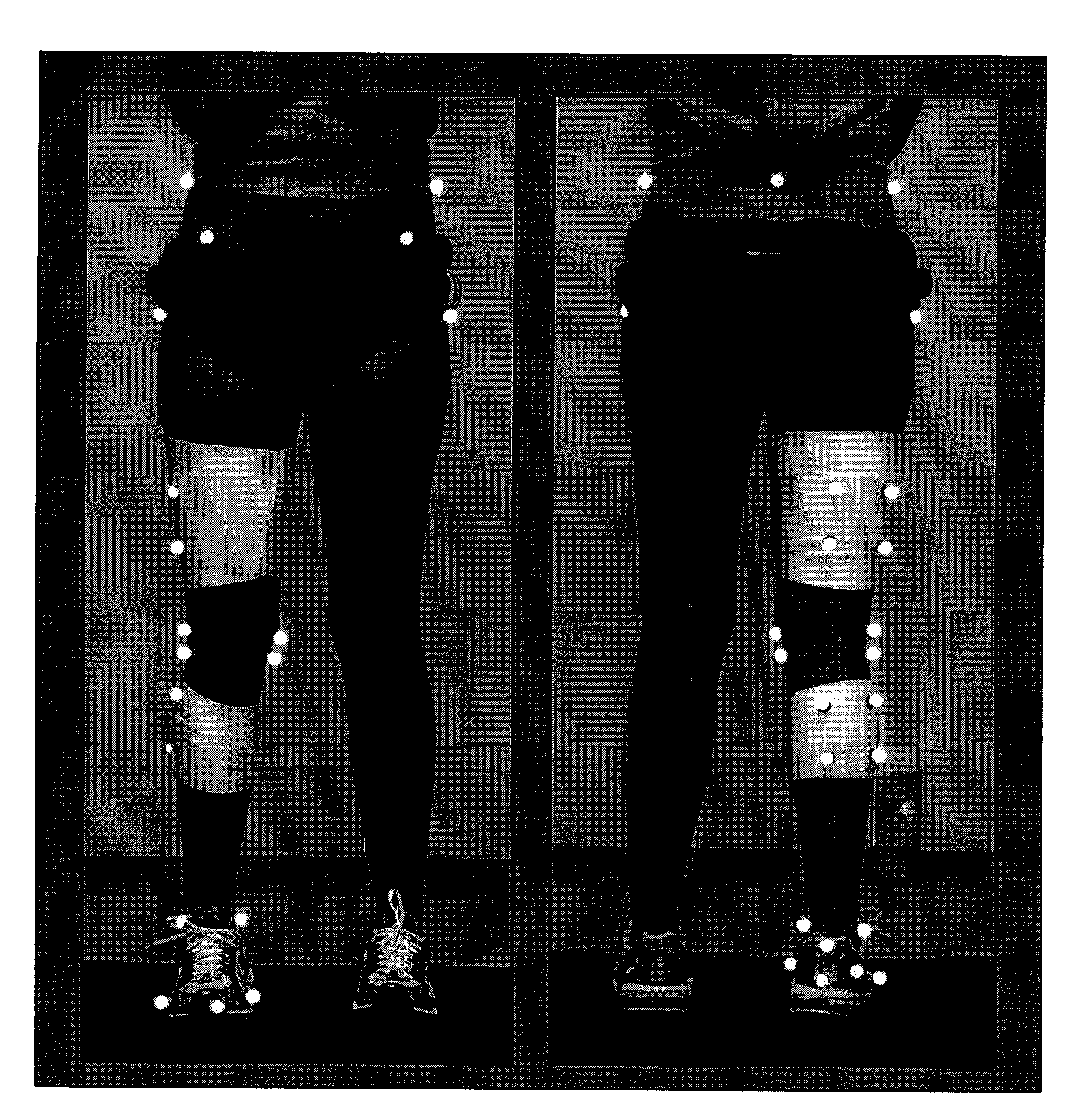 Method for auxiliary evaluation of stress states of knee joints