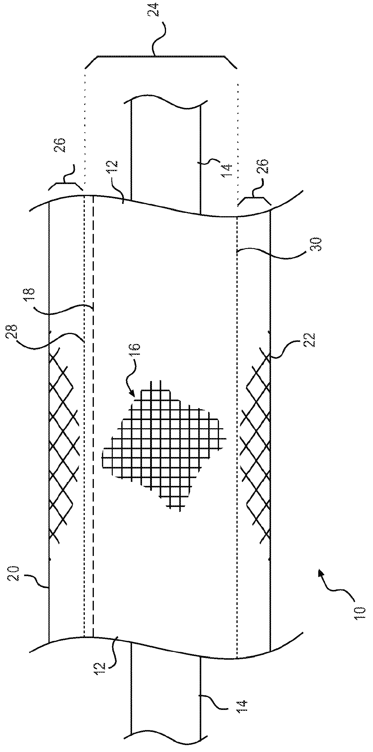 Wire casing and method of making the same