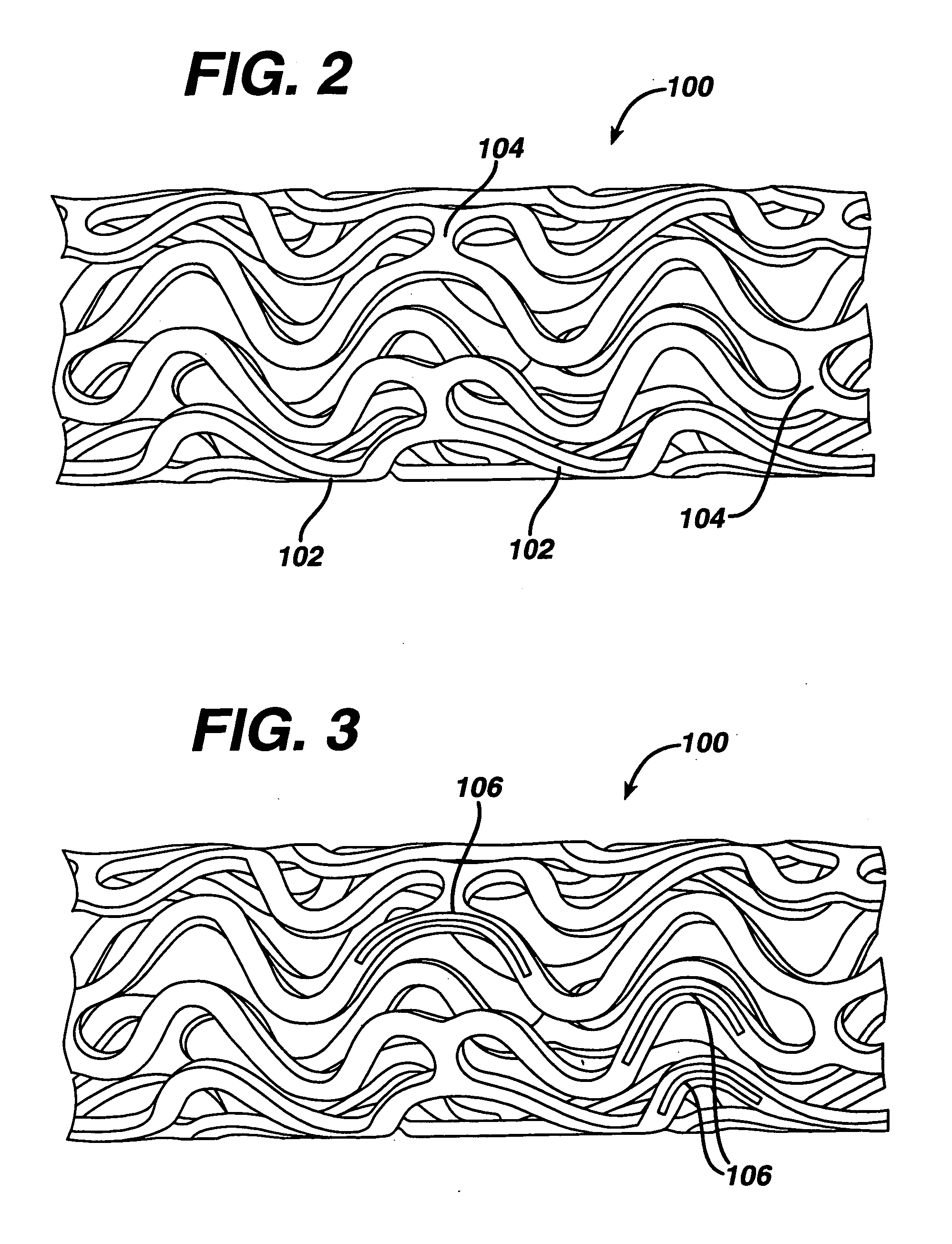 Drug/drug delivery systems for the prevention and treatment of vascular disease