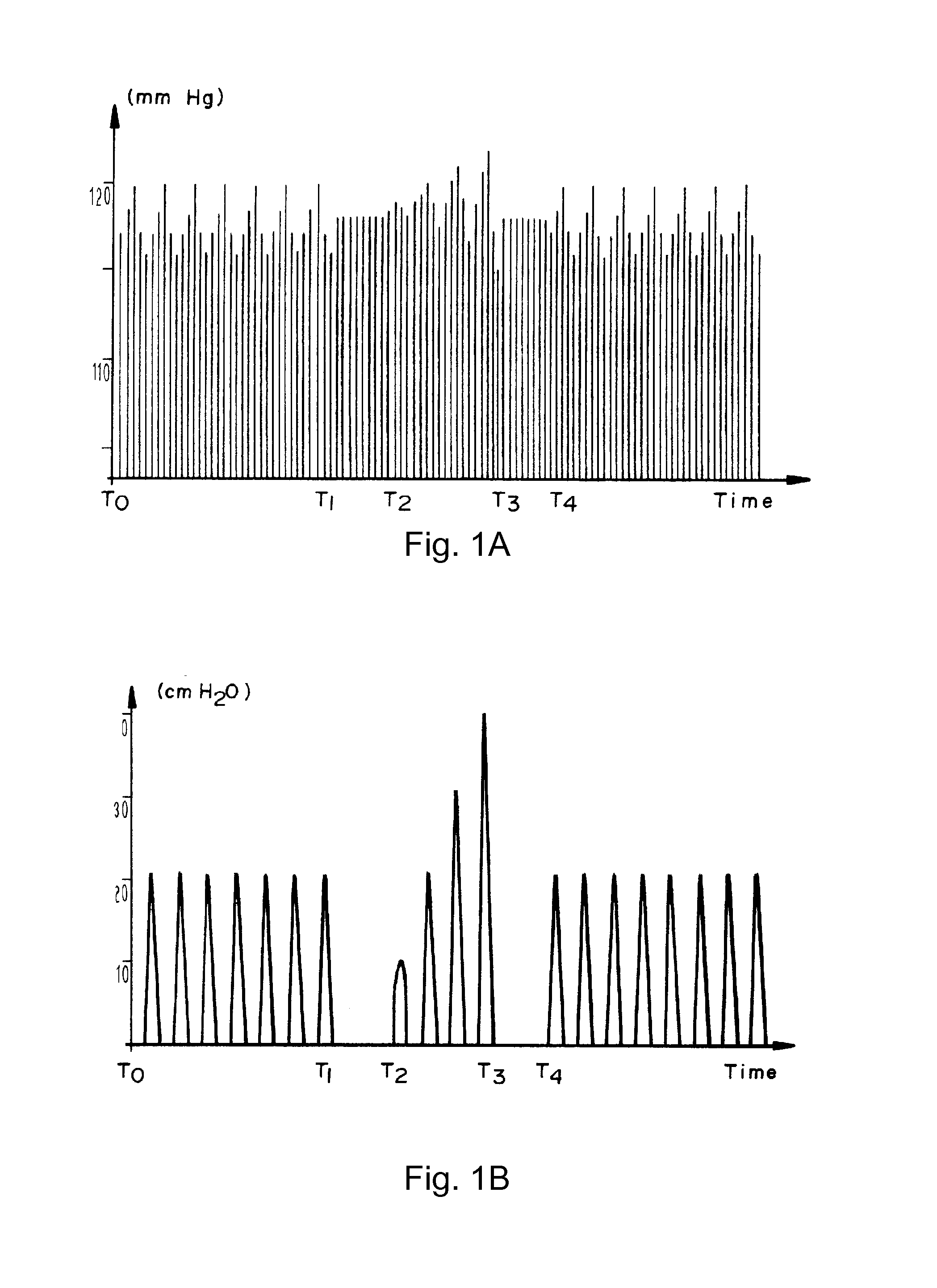 Indicator for fluid resuscitation