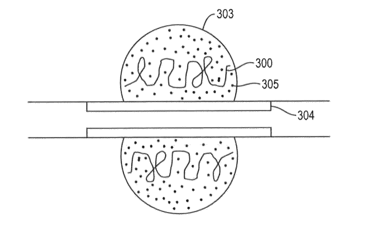 In-situ forming foams with outer layer