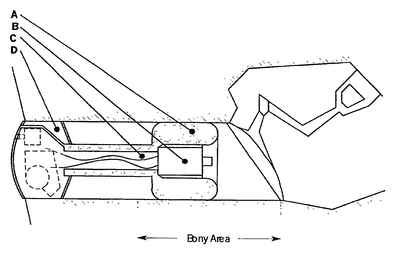 Expandsible Receiver Module