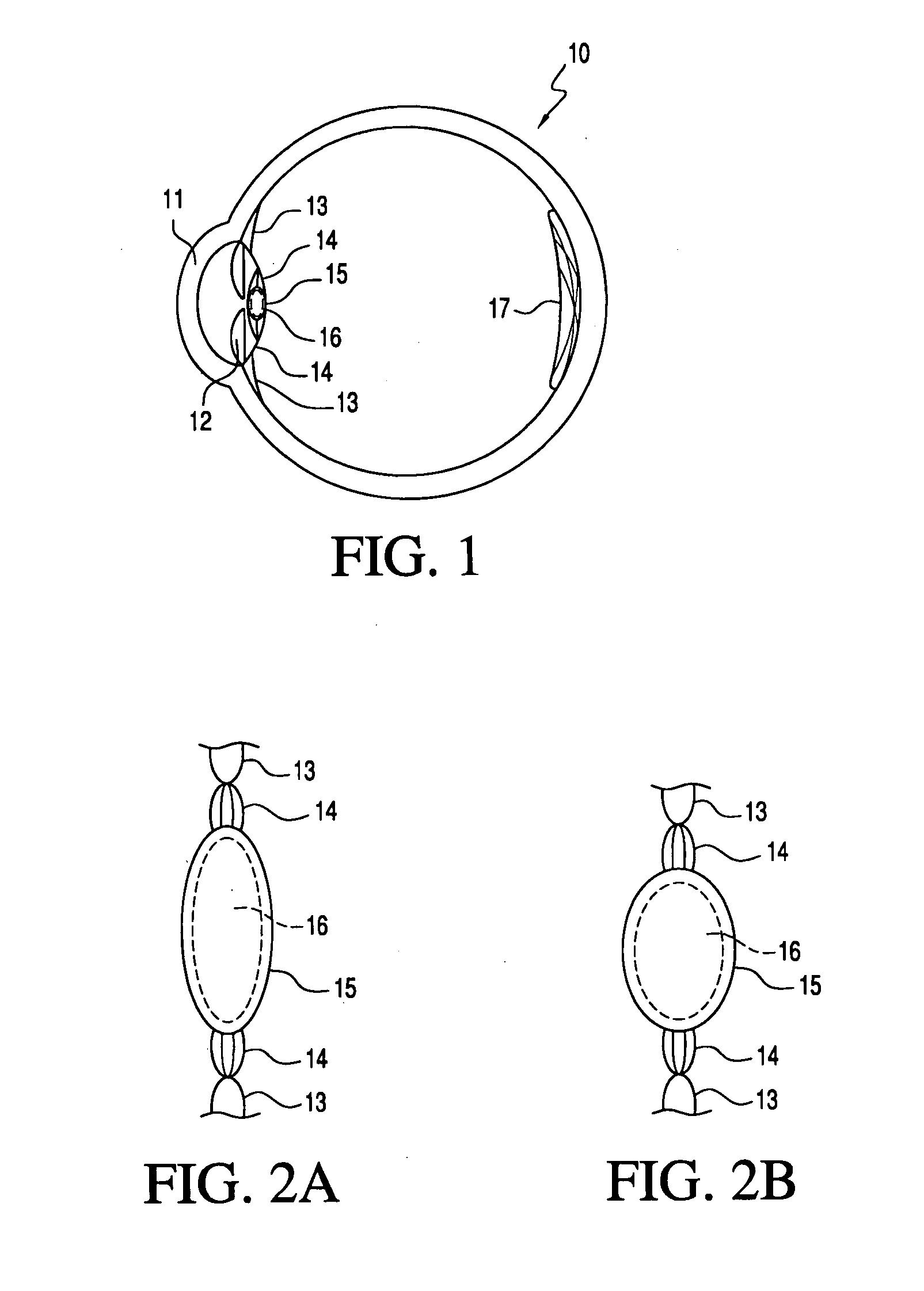 Accommodating intraocular lens system utilizing direct force transfer from zonules and method of use