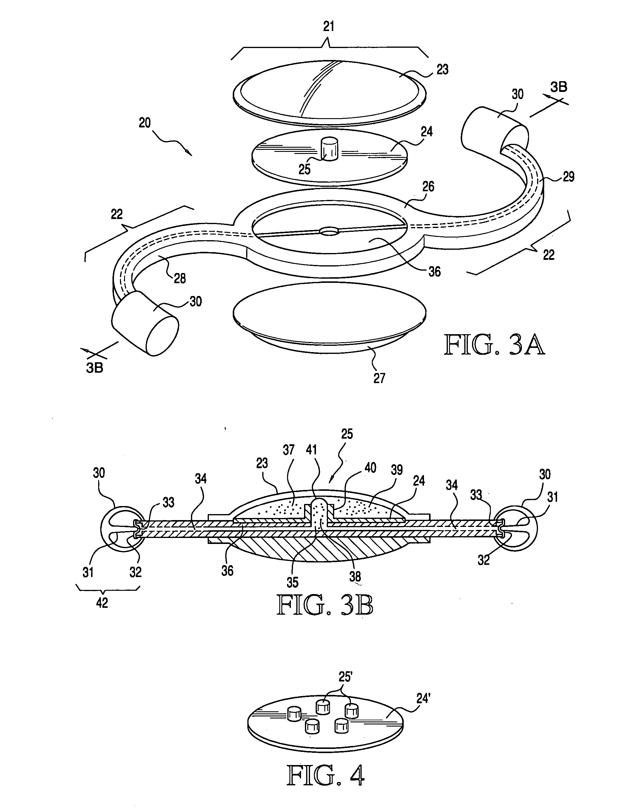 Accommodating intraocular lens system utilizing direct force transfer from zonules and method of use