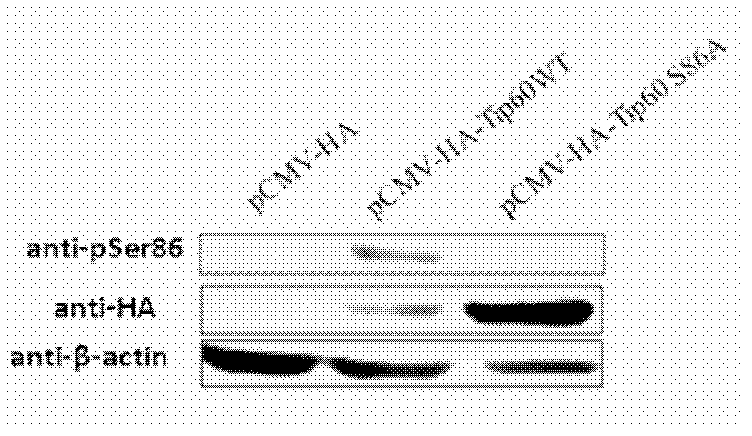 PSer86 monoclonal antibody of Tip60, as well as preparation method and application of pSer86 monoclonal antibody