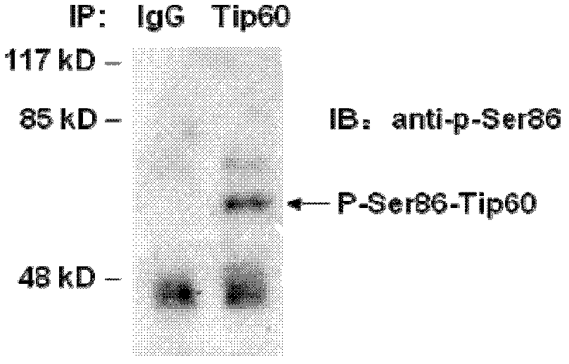 PSer86 monoclonal antibody of Tip60, as well as preparation method and application of pSer86 monoclonal antibody
