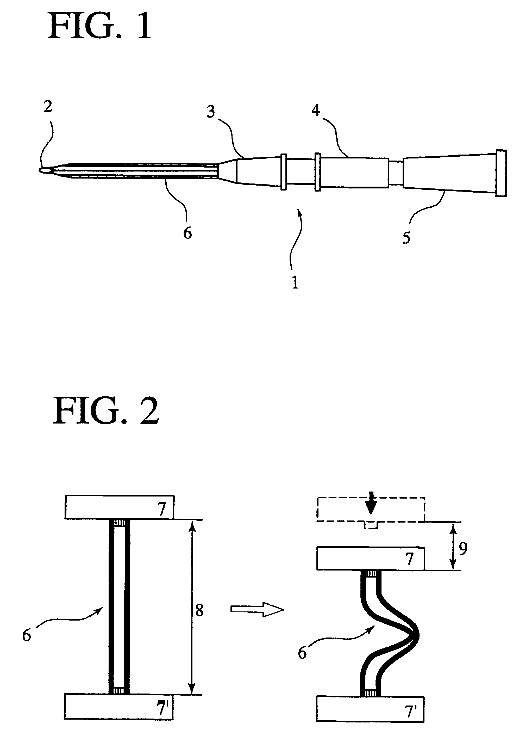 Indwelling catheter