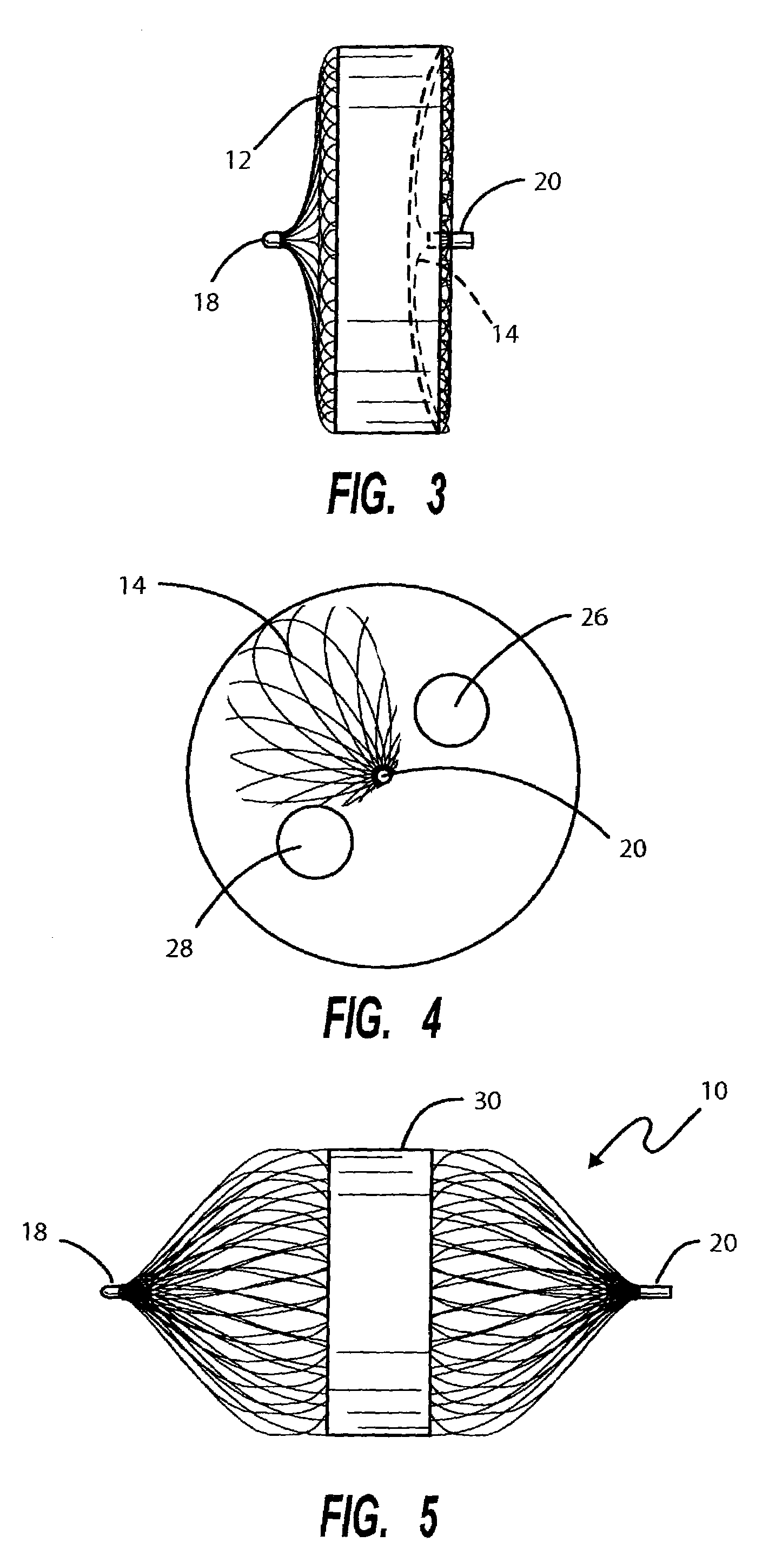 Intravascular flow restrictor